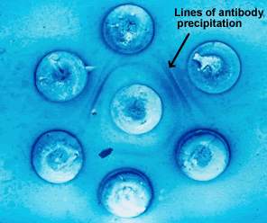 Double Diffusion test for Aspergillosis