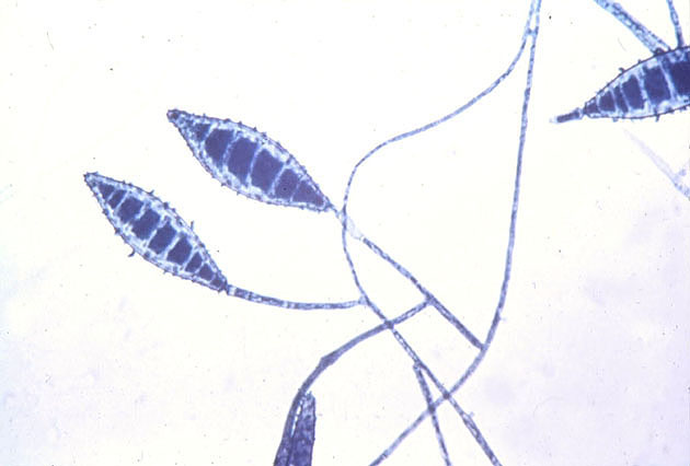 The 
      
 
 
 
 
 
 
 
 macroconidia of Microsporium Canis