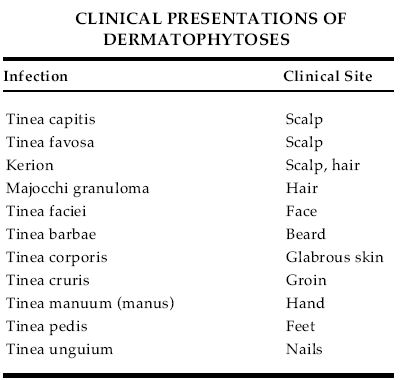 clinical presentaion of dermatophytes