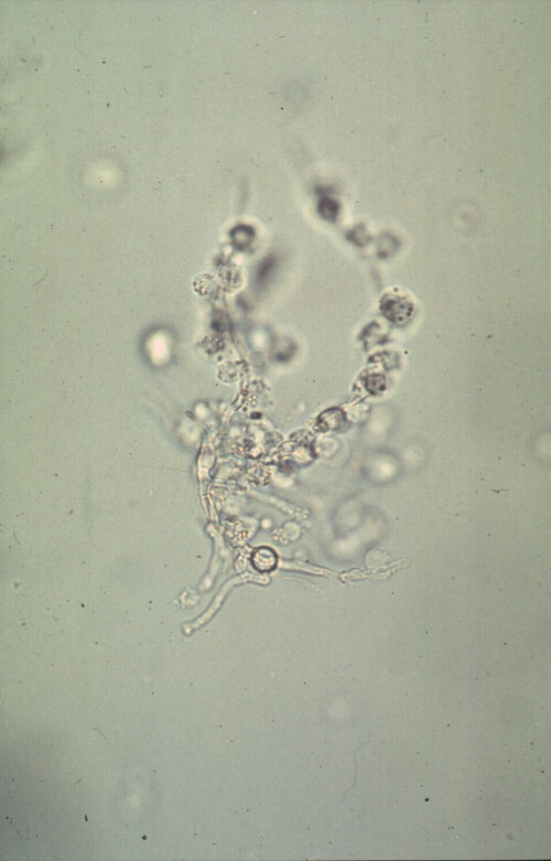 hyphae